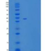 人DNA聚合酶β重组蛋白C-6His