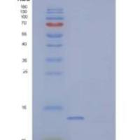 人小白蛋白(PVALB)重组蛋白C-6His