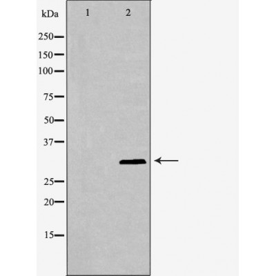 CDKN1C Antibody