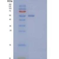人宿主细胞因子C2(HCFC2)重组蛋白N-6His