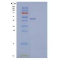 人鸟氨酸脱羧酶(ODC)重组蛋白C-6His, N-T7 tag