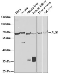 ALG1 antibody