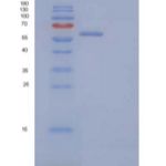 人免疫球蛋白超家族成员8/IGSF8/CD316重组蛋白C-6His
