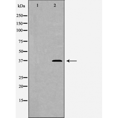 AKR1A1 Antibody