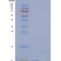 人子宫珠蛋白相关蛋白1/UGRP1重组蛋白
