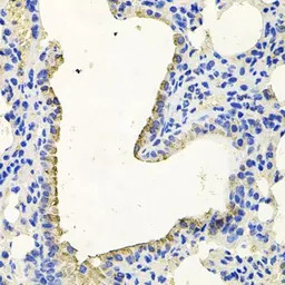 PKN1 antibody