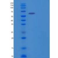 人丁酰胆碱酯酶重组蛋白