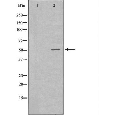 IL-6R Antibody