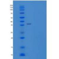 人缺氧上调蛋白1/hyu 1重组蛋白C-10His