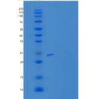 人包含V-Set和免疫球蛋白结构域的蛋白质2重组蛋白