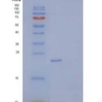 人组织金属蛋白酶抑制因子2(TIMP2)重组蛋白C-6His