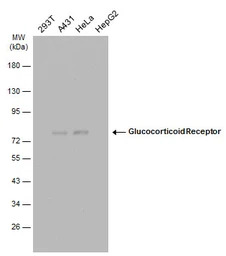 Glucocorticoid Receptor antibo