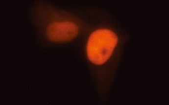 多功能单细胞显微操作系统-FluidFM OMNIUM