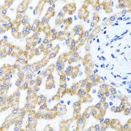 RIPK4 antibody
