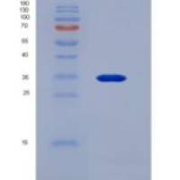 人胸腺生成素(TMPO)重组蛋白