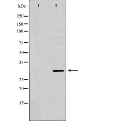 KLK5 Antibody