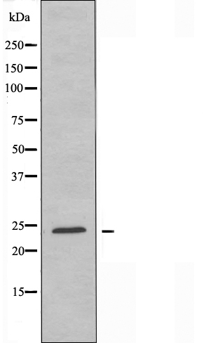 CBLN1 Antibody