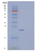 人细胞球蛋白(CYGB)重组蛋白C-6His