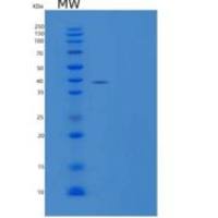 人GMP还原酶1重组蛋白