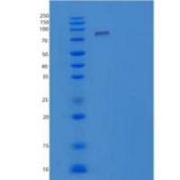 人大型同源盘4/DLG4/PSD95重组蛋白N-6His