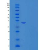 人网膜素/凝集素-1/ITLN-1重组蛋白N-6His