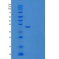 人网膜素/凝集素-1/ITLN-1重组蛋白N-6His