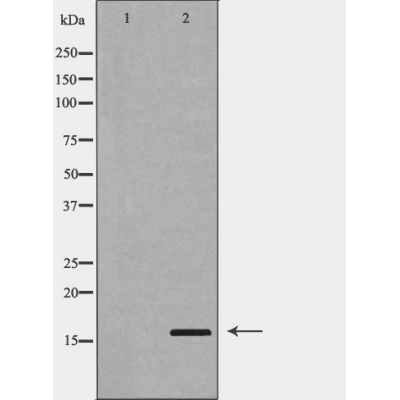 PLA2G2A Antibody