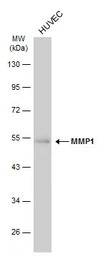 MMP1 antibody [GT2649]