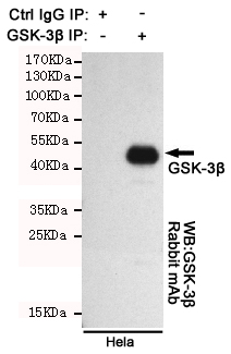GSK3 β Mouse mAb