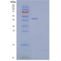 人IL-22受体亚单位α2/IL-22BP/IL-22RA2重组蛋白C-Fc