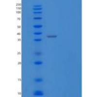 人白细胞介素1受体样2/白细胞介素1受体2重组蛋白C-6His