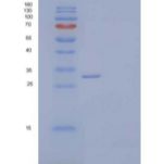 人CLEC10A/CD301重组蛋白C-6His