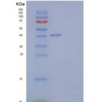 人THSD1/TMTSP重组蛋白C-6His