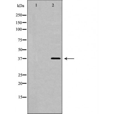 FST Antibody