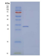 人白介素-12亚单位β/白介素-12 p40/白介素-12B