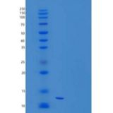 人三叶因子2(TFF2)重组蛋白C-6His