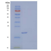 人尿嘧啶核苷磷酸化酶1(UPP1)重组蛋白N-6His