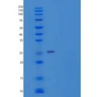 人醌型二氢蝶啶还原酶(QDPR)重组蛋白C-6His