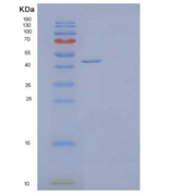 人脱氧羟脯氨酸合酶/DHS重组蛋白C-6His