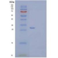 人补体因子H相关蛋白2(CFHR2)重组蛋白C-6His