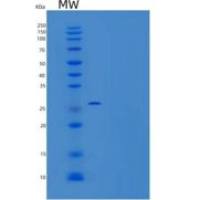人肝细胞生长因子/HGF/肝细胞生成素-A重组蛋白C-6His