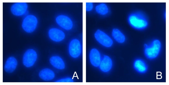 活细胞染色液(Hoechst 33342)(100×)