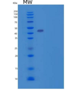 人ACADM/MCAD重组蛋白N-6His
