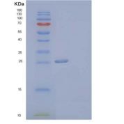 人凝血因子ⅲ/组织因子/CD142重组蛋白C-6His