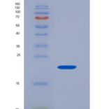 人CD32a / FCGR2A重组蛋白166 Arg, His tag