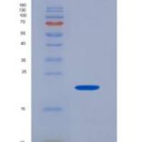 人CD32a / FCGR2A重组蛋白166 Arg, His tag