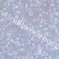 CAL-62/CAL-62细胞/CAL62细胞/CAL62/人甲状腺癌细胞(未分化)/STR鉴定/镜像绮点(Cellverse)