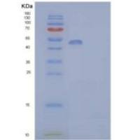 人乙醛脱氢酶家族3成员A1重组蛋白