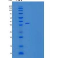 小鼠白细胞介素-12亚单位β/白细胞介素-12 p40/白细胞介素-12B重组蛋白C-6His