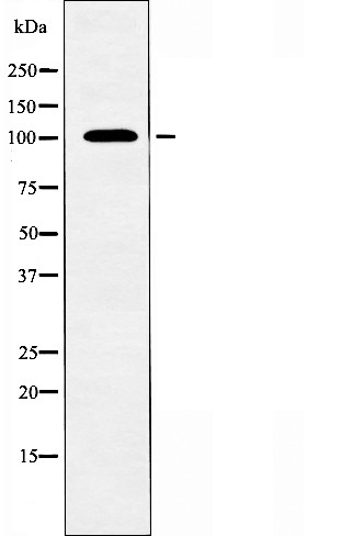 ATP2A1 Antibody